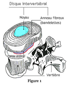 disque intervertébrale